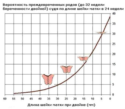 Uterin în timpul sarcinii, gemeni de gât, mărime, gât scurtat