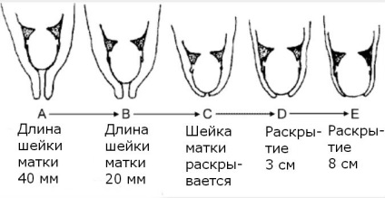 Uterin în timpul sarcinii, gemeni de gât, mărime, gât scurtat