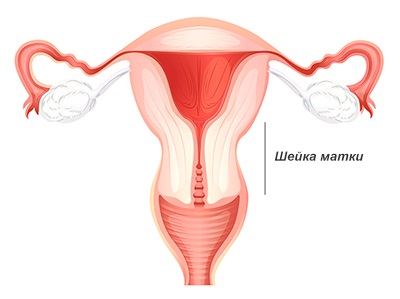 Myoma méhnyaki tünetek, kezelés (eltávolítás), terhességre gyakorolt ​​hatás