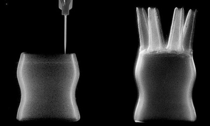 O nouă metodă de imprimare 3d a siliconului va face implanturile în câteva ore (video)