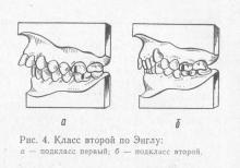 Clasificarea generală a anomaliilor dentoalveolare, stomatologia ortopedică