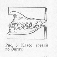 Clasificarea generală a anomaliilor dentoalveolare, stomatologia ortopedică