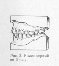 Clasificarea generală a anomaliilor dentoalveolare, stomatologia ortopedică