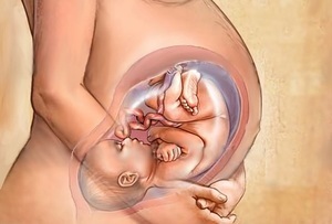 Cablul cordonului ombilical în jurul gâtului fătului 1 cauze de patologie, tipuri și rezoluție a sarcinii