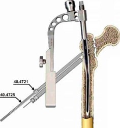 Osteosinteza femurului proximal