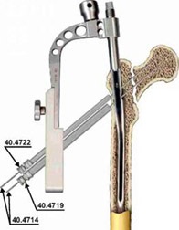 Osteosinteza femurului proximal