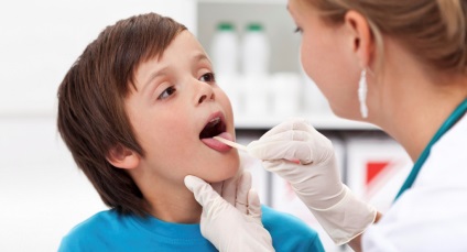 Akut pharyngitis tünetek és kezelés gyermekeknél, okok és megelőzés, egészséges online