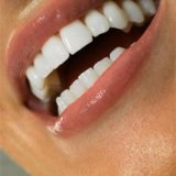 Albirea dinților la domiciliu - medicul dumneavoastră este un abobolit
