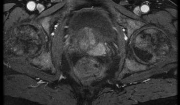 Departamentul de Urologie, CKPS, Oncologie