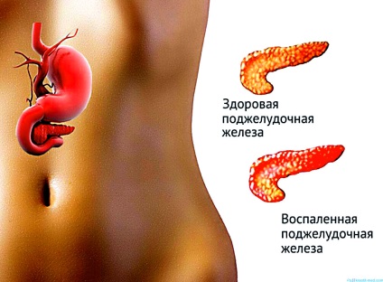 Pancreatită, pancreas