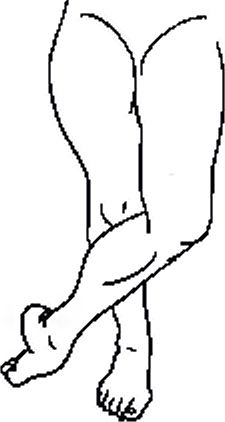Musculatura anterioară a tibialului (durere din partea interioară a părții anterioare a gleznei și a degetului mare)