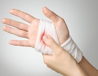 Regulile pentru aplicarea unui turnichet în timpul sângerării și pentru cât timp poate fi impus