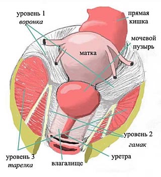 Prolaps (omisiune, prolaps) a organelor pelvine