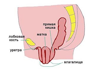 Prolaps (omisiune, prolaps) a organelor pelvine