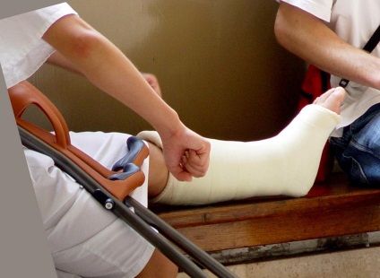 Rehabilitáció egy törött láb után