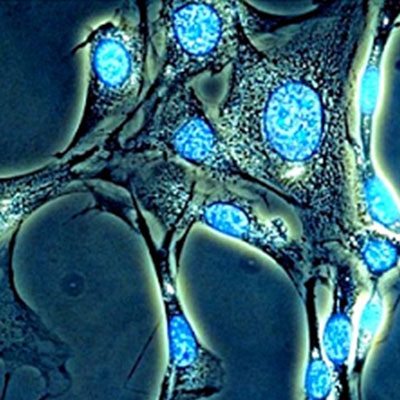 Celulele stem Interesante, Abriell