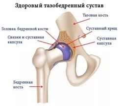 Anatomia articulației șoldului și tot ce trebuie să știți