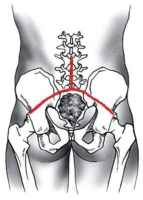 Eliminarea totală a sacrului în leziunea tumorală, oncologie clinică