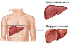 Afectarea alcoolului pe video-ul corpului uman