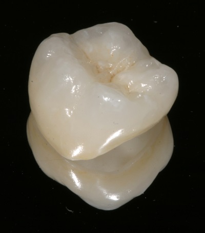 Coroane dentare