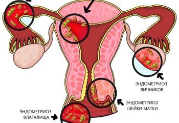 Uterul Borovoy cu recenzii ale medicilor despre acest medicament