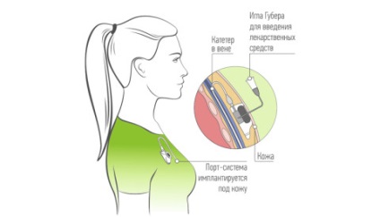 Centrul de chirurgie radiologică bazat pe Clinica Europeană