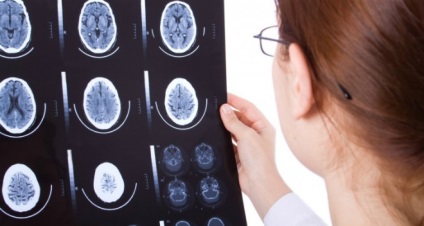 Ceea ce arată mirosul vaselor cerebrale și simptomele diagnosticului