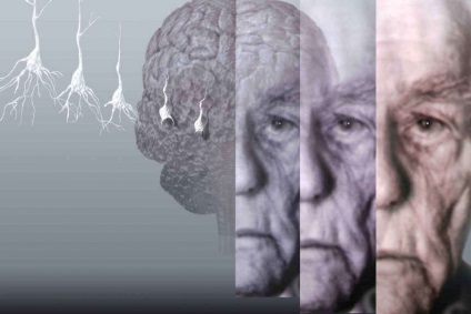Demență la vârstnici, tratamentul demenței senile