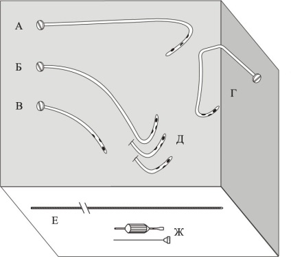 Endoproteticele conductelor biliare