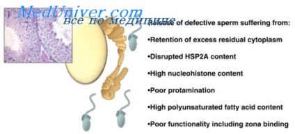 Indicele defectelor multiple ale spermatozoizilor