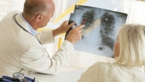 Как да се идентифицират рак на белия дроб, отделят внимание на предупредителните сигнали за белодробни заболявания