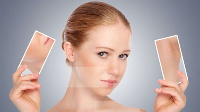 Cum să elimini rapid și eficient petele de acnee pe față
