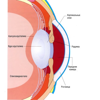 Cataracta cauze, simptome, tratament si prevenirea bolilor