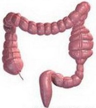 Simptome, cauze și tratament al obstrucției intestinale