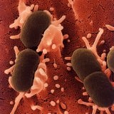 Klebsiella - intesztinális fertőzés és népi gyógymódok - szike - orvosi