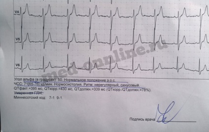 Cumpărați un ecg fără doctor în Moscova