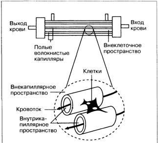 Лікування фульмінантний печінкової недостатності