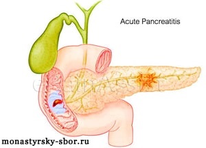 Tratamentul pancreatitei cu ierburi