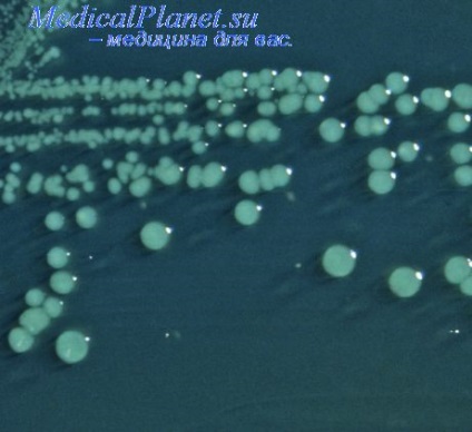 Mica Shigellosis