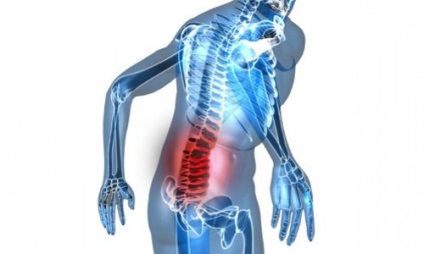 Rame de masaj și alte tipuri de aplicatoare pentru tratarea spatelui și articulațiilor