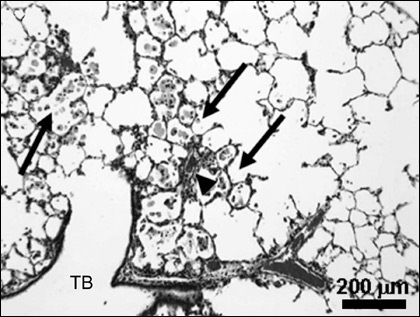 Pericolul nanomaterialelor pentru mituri de sănătate sau o nouă amenințare, nanotehnologia nanotehnologiei