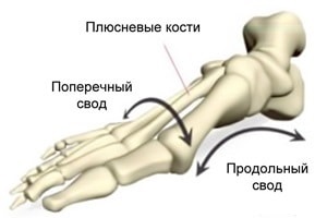 Apariția cauzelor, simptomelor, tipurilor și etapelor de picior plat