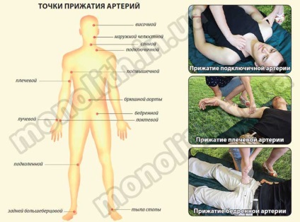 Procedura de asistare a sângerărilor externe