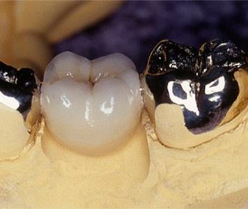 Protetica dentară