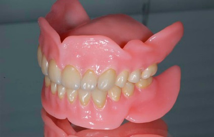 Protetikus fogászat