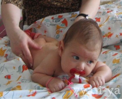 O hernie ombilicală la simptomele unui copil de o lună