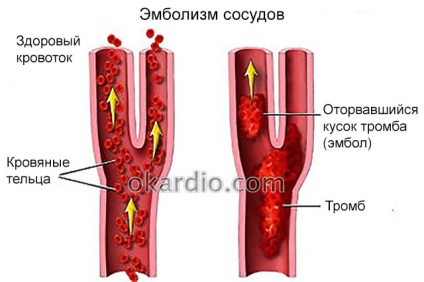 szívrák tünetei emberi papillomavírus és szájrák