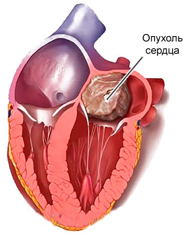 Szívrák – Wikipédia
