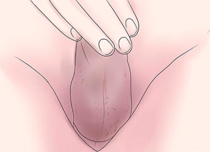Simptomele testiculelor lasate pot fi detectate independent