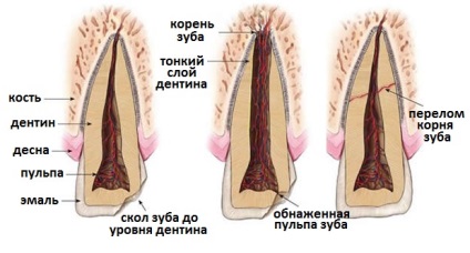 Leziuni cauzate de dinți, prim ajutor pentru traume dentare acute și opțiuni de tratament - informații despre simptome